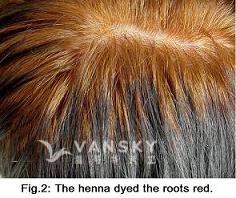 251230161710_Hair-Dying with henna-s.jpg